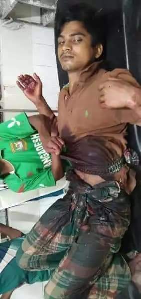 লালমাইয়ে তুচ্ছ ঘটনায় ১জন ছুরিকাহত
