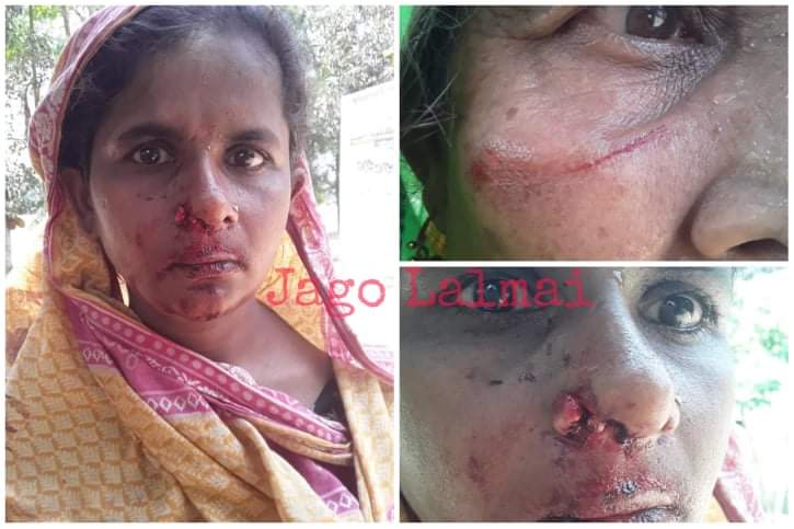ভূলইন উত্তরের বেতাগাঁও’য়ে প্রবাসীর পরিবারের উপর হামলার অভিযোগ; আহত ৩