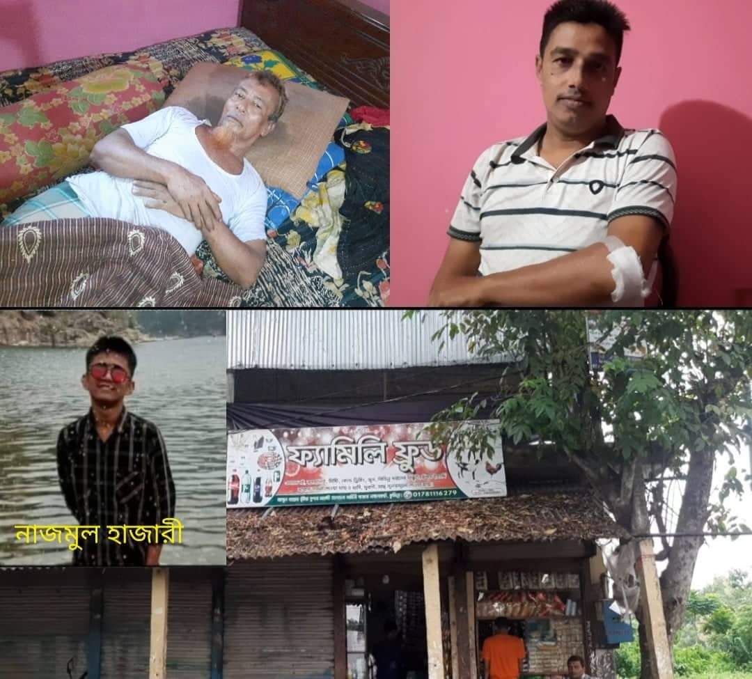 নাঙ্গলকোটে কিশোর গ্যাংয়ের হামলায় ব্যবসায়ী,ছাত্রলীগ নেতা সহ আহত ৩